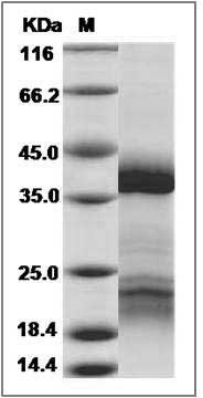Cynomolgus IGFBP5 / IGFBP-5 Protein (His Tag) SDS-PAGE