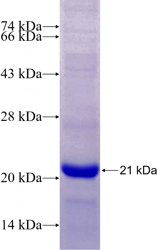 Recombinant Human CPT1C SDS-PAGE