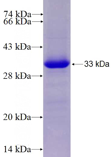 Recombinant Human WDR88 SDS-PAGE