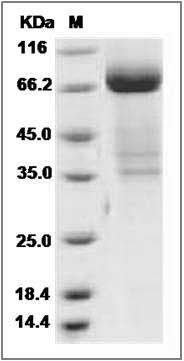 Human IL17BR / IL17RB / IL-17 Receptor B Protein (Fc Tag) SDS-PAGE