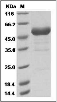 Human RNF43 Protein (Fc Tag) SDS-PAGE