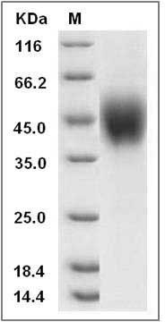 Rat IL2RG / CD132 Protein (His Tag) SDS-PAGE