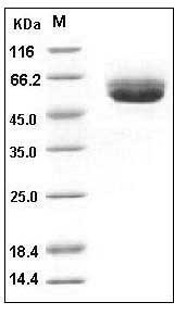 Mouse CD5L / CD5 antigen-like Protein (His Tag) SDS-PAGE