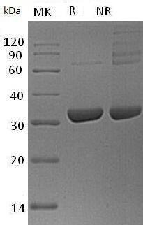 Human ANXA10/ANX14 recombinant protein
