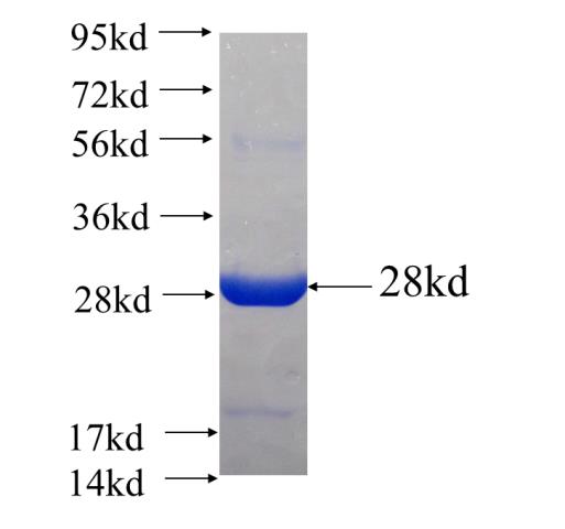 Recombinant Arabidopsis thaliana ATCS SDS-PAGE