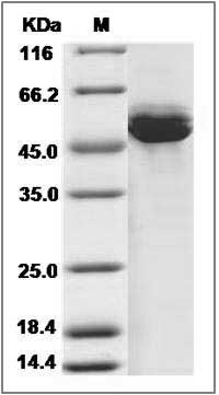 Cynomolgus AMY2A / Alpha-amylase Protein (His Tag) SDS-PAGE