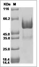 Canine CD137 / 4-1BB / TNFRSF9 Protein (Fc Tag) SDS-PAGE