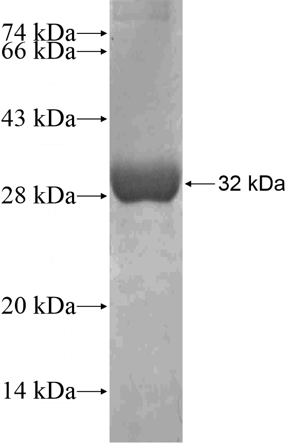 Recombinant Human MIF4GD SDS-PAGE
