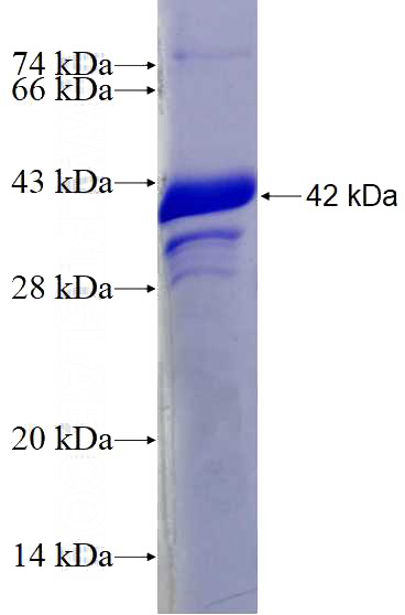 Recombinant Human BMP-7 SDS-PAGE