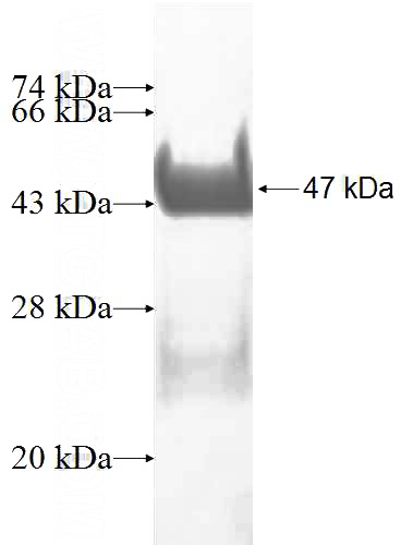 Recombinant Human PAGE4 SDS-PAGE