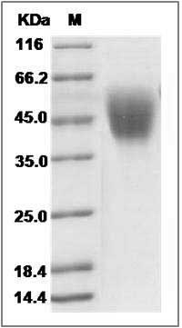 Human B7-H4 / B7S1 / B7x Protein (His Tag) SDS-PAGE