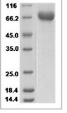 Rat C1 inhibitor/SerpinG1 Protein 15531
