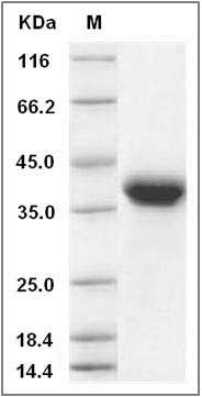 Rat EpCAM / TROP-1 / TACSTD1 Protein (His Tag) SDS-PAGE