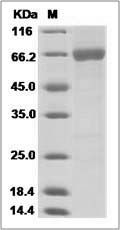 Influenza B (B/Utah/02/2012) Hemagglutinin / HA Protein (His Tag)