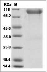 Human FGFR3 / CD333 Protein (alpha(IIIb), Fc Tag)