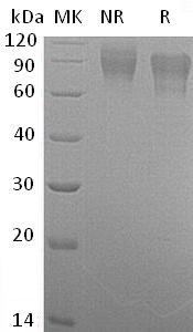 Human F9 (His tag) recombinant protein