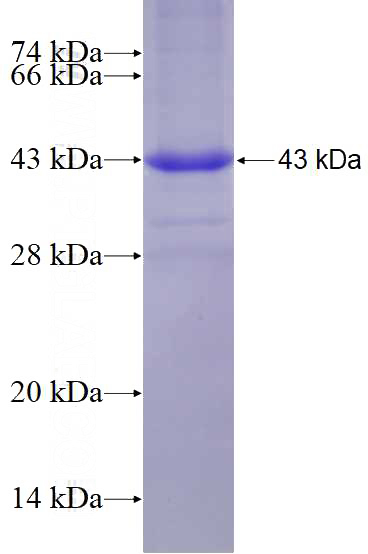 Recombinant Human WDR19 SDS-PAGE