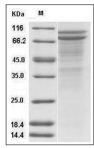 Human DSC2 / Desmocollin-2 Protein (His Tag) SDS-PAGE