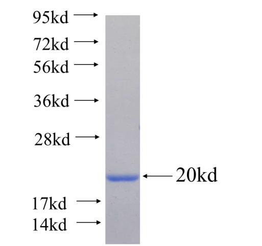 Recombinant human LIG3 SDS-PAGE
