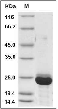 Canine RBP4 Protein (His Tag) SDS-PAGE