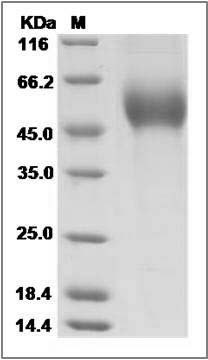 Influenza A H1N1 (A/Ohio/07/2009) Hemagglutinin Protein (HA1 Subunit) (His Tag) SDS-PAGE