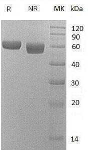 Mouse Lgmn/Prsc1 (His tag) recombinant protein