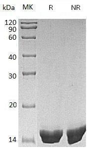 Human CST5 (His tag) recombinant protein