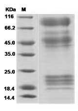Ebola virus EBOV (subtype Zaire, strain H.sapiens-wt/GIN/2014/Kissidougou-C15) Glycoprotein / GP Protein (His Tag)