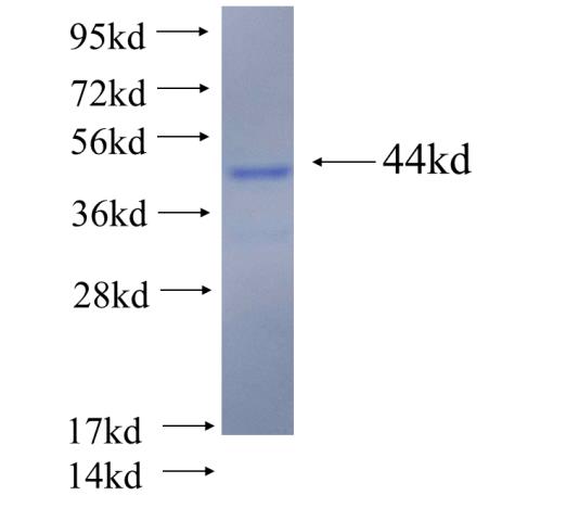Recombinant human PHYHIP(Full length) SDS-PAGE