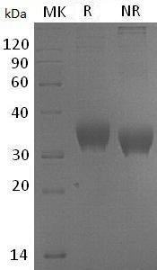 Human SLAMF8/BLAME (His tag) recombinant protein
