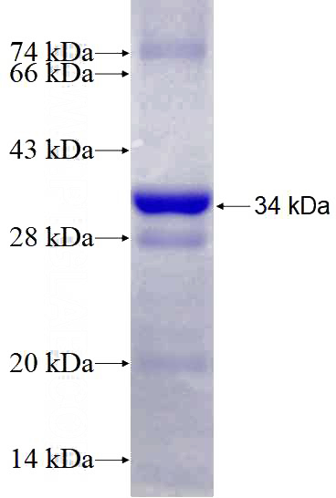 Recombinant Human TERF2 SDS-PAGE