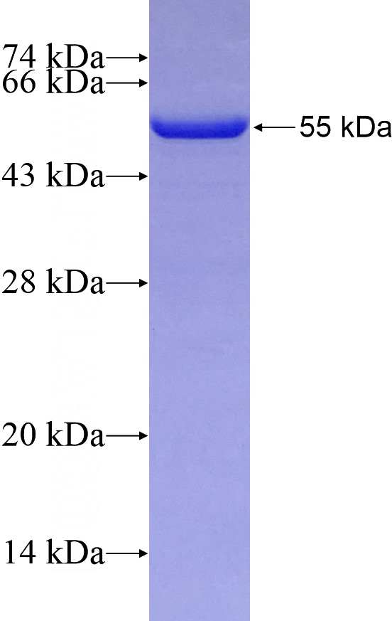 Recombinant Human SNX1 SDS-PAGE