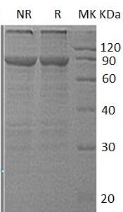 Human CAPN2/CANPL2 (His tag) recombinant protein