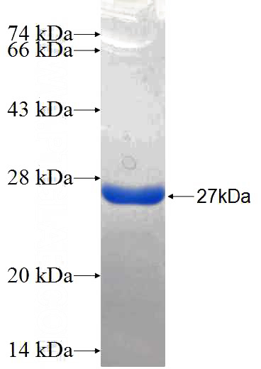 Recombinant Human CEP170 SDS-PAGE