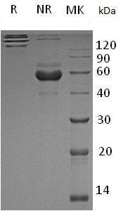 Human TREML1/TLT1/UNQ1825/PRO3438 (Fc tag) recombinant protein