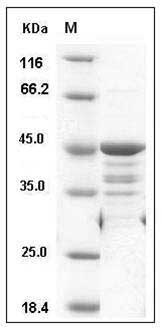 Human WTAP Protein (GST Tag) SDS-PAGE