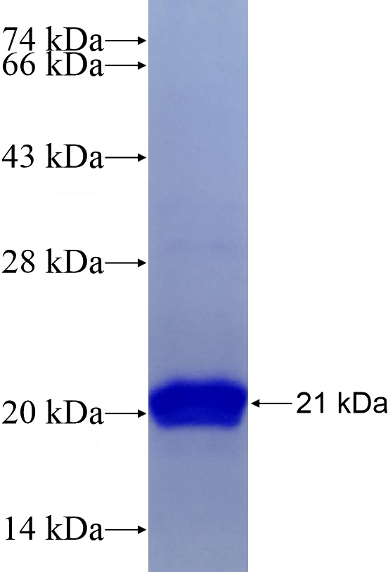 Recombinant Human Histone H2A.X SDS-PAGE