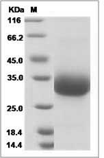 Rat PD1 / PDCD1 / CD279 Protein (His Tag)