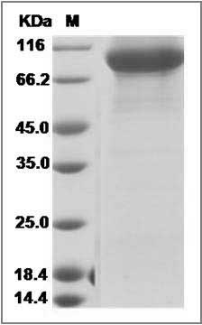 Human FLT-3 / CD135 / FLK-2 Protein (His Tag) SDS-PAGE