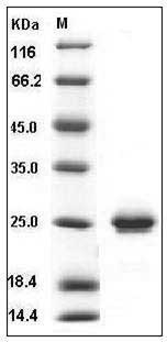 Human CD32a / FCGR2A Protein (166 Arg, His Tag) SDS-PAGE