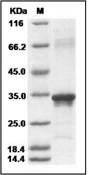 Human Beta-amyloid 39 / Beta-APP39 Protein (aa 672-710, His & GST Tag) SDS-PAGE