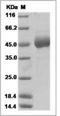 Sudan ebolavirus GP / Glycoprotein Protein (His Tag) SDS-PAGE