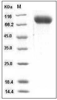Mouse ICAM-1 / CD54 Protein (His Tag) SDS-PAGE