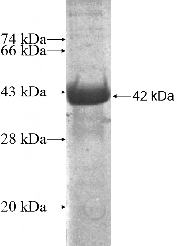 Recombinant Human C7orf58 SDS-PAGE