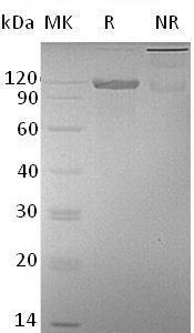 Mouse Alcam (Fc tag) recombinant protein