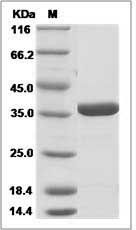 Rat LDH-A / LDHA Protein (His Tag)