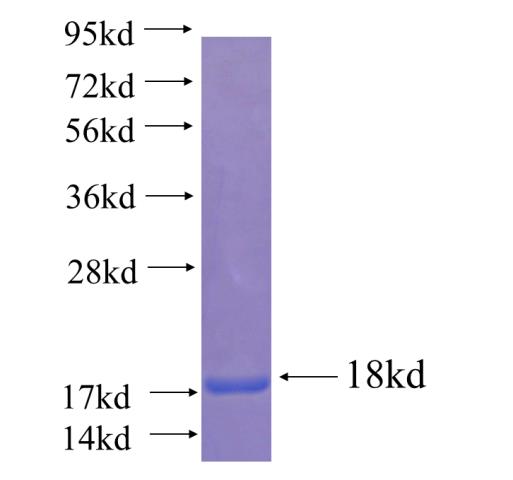 Recombinant human CCDC21 SDS-PAGE