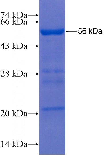 Recombinant Human WDR26 SDS-PAGE