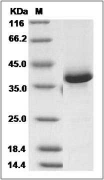 Human CALCB / CGPR / Calcitonin 2 Protein (Fc Tag) SDS-PAGE