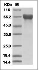 Influenza A H3N2 (A/Nanchang/933/1995) Hemagglutinin / HA Protein (His Tag)